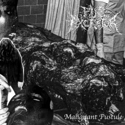Pus Excretor - Malignant Pustule LP
